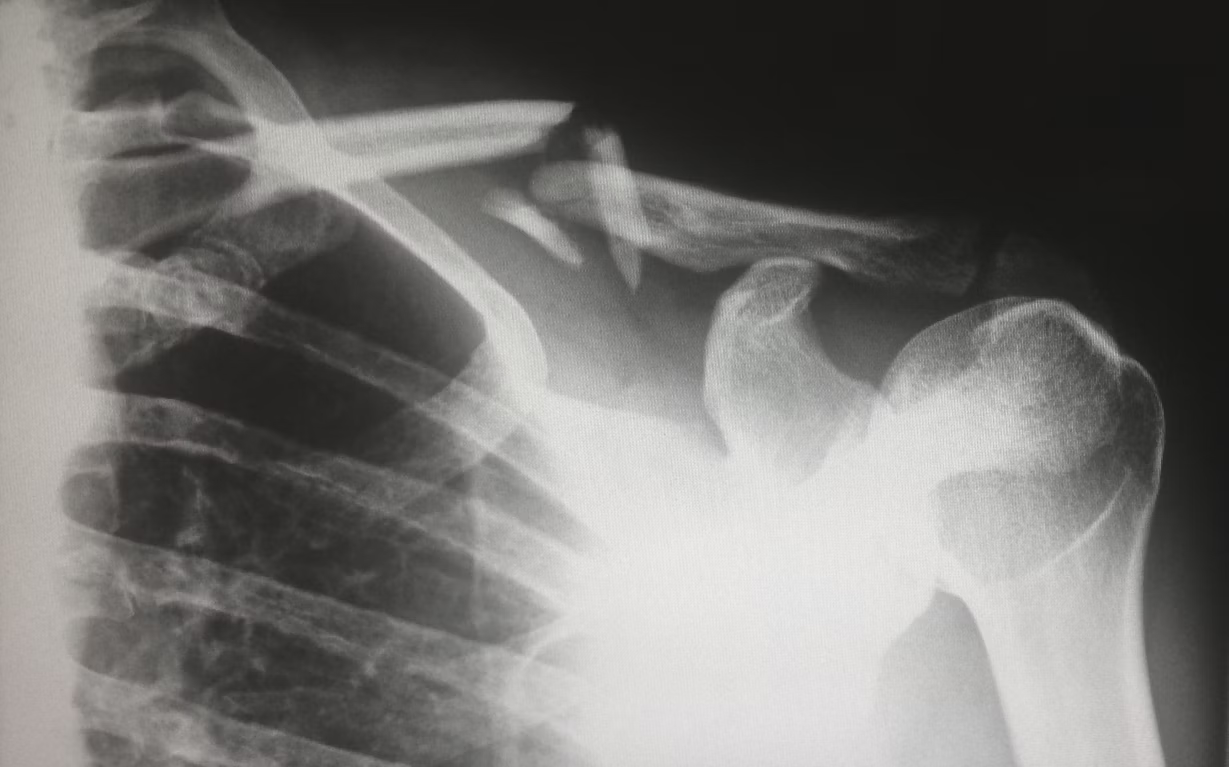 How to Decide on a Surgery: A Guide for Complex Upper Limb Procedures