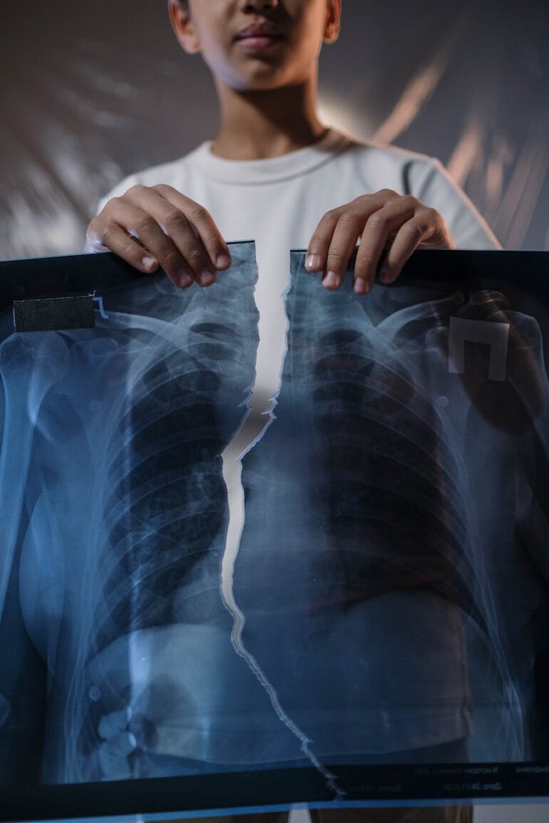 Define Mutilation How Are Catastrophic Injuries Defined? » Sunny Sweet Days